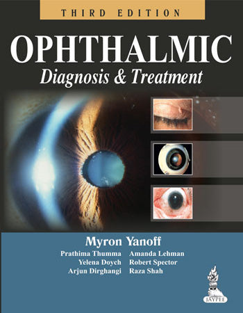 OPHTHALMIC DIAGNOSIS & TREATMENT, 3/E, BY, MYRON YANOFF
