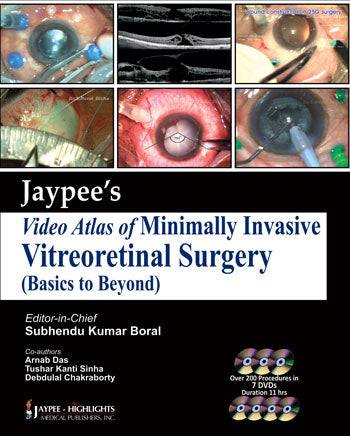 JAYPEE VIDEO ATLAS OF MINIMALLY INVASIVE VITREORETINAL SURGERY 1/E, 2013, SUBHENDU KUMAR BORAL