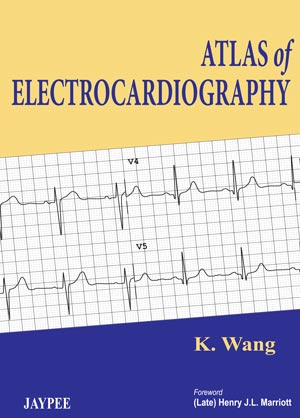 ATLAS OF ELECTROCARDIOGRAPHY, 1/E, BY, K WANG