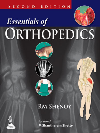 ESSENTIALS OF ORTHOPEDICS 2/E, 2014, RM SHENOY