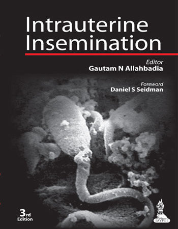 INTRAUTERINE INSEMINATION 3/E, 2014, GAUTAM N ALLAHBADIA