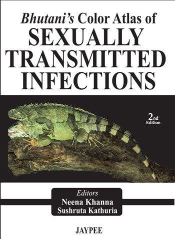 BHUTANI'S COLOR ATLAS OF SEXUALLY TRANSMITTED INFECTIONS, 2/E R.P., BY, NEENA KHANNA