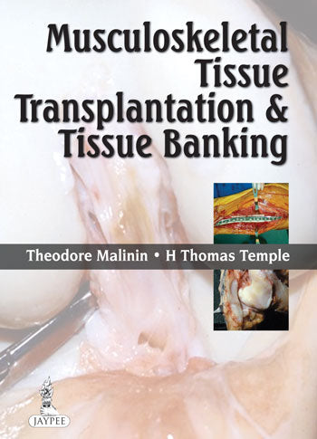 MUSCULOSKELETAL TISSUE TRANSPLANTATION & TISSUE BANKING 1/E, 2013, THEODORE MALININ