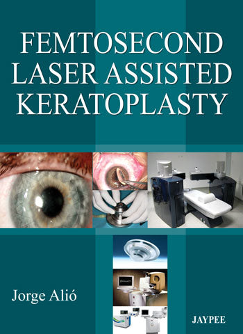 FEMTOSECOND LASER ASSISTED KERATOPLASTY, 1/E, BY, JORGE L ALIO