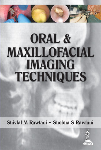 ORAL & MAXILLOFACIAL IMAGING TECHNIQUES 1/E, 2014, SHIVLAL M RAWLANI