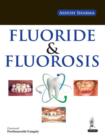 FLUORIDE & FLUOROSIS, 1/E, BY, ASHISH SHARMA