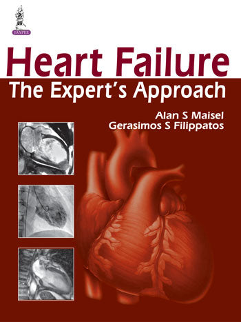 HEART FAILURE THE EXPERT'S APPROACH 1/E, 2014, ALAN S MAISEL