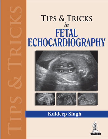 TIPS & TRICS IN FETAL ECHOCARDIOGRAPHY, 1/E, BY, KULDEEP SINGH