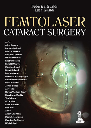 FEMTOLASER CATARACT SURGERY 1/E, 2014, FEDERICA GUALDI