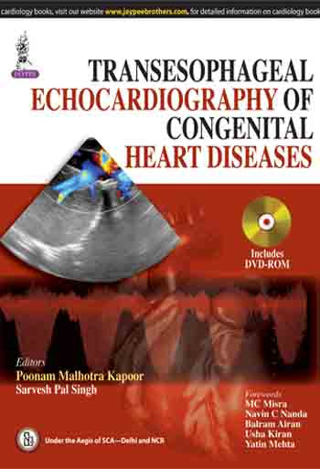 TRANSESOPHAGEAL ECHOCARDIOGRAPHY OF CONGENITAL HEART DISEASES, 1/E, BY, POONAM MALHOTRA KAPOOR