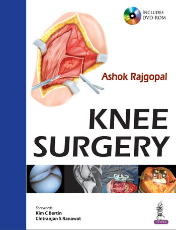KNEE SURGERY INCLUDES DVD-ROM, 1/E, BY, ASHOK RAJGOPAL