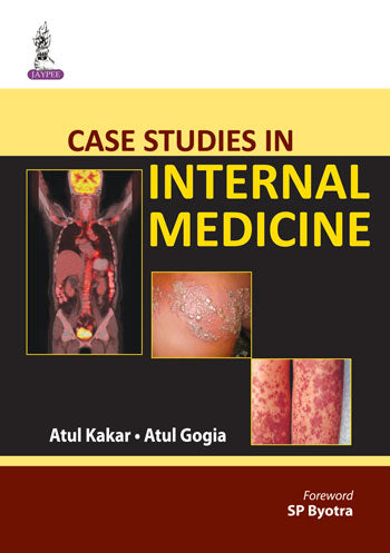 CASE STUDIES IN INTERNAL MEDICINE, 1/E, BY, ATUL KAKAR