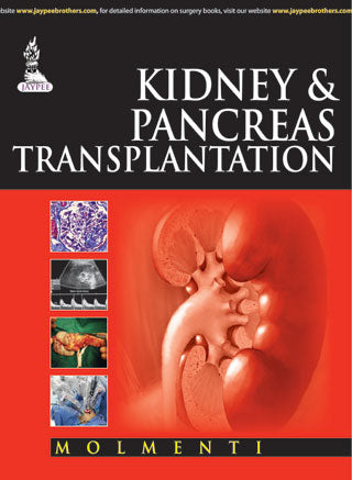 KIDNEY & PANCREAS TRANSPLANTATION, 1/E, BY, ERNESTO POMPEO MOLMENTI