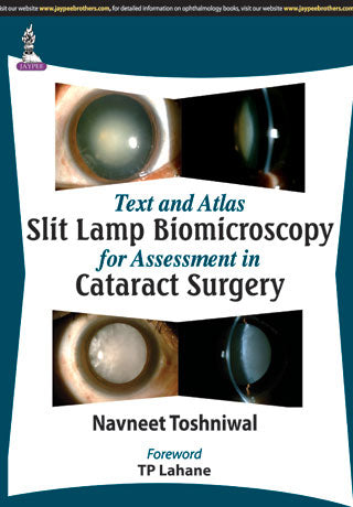 TEXT AND ATLAS SLIT LAMP BIOMICROSCOPY FOR ASSESSMENT IN CATARACT SURGERY, 1/E, BY, NAVNEET TOSHNIWAL