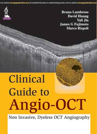CLINICAL GUIDE TO ANGIO-OCT: NON INVASIVE,DYELESS OCT ANGIOGRAPHY, 1/E, BY, BRUNO LUMBROSO
