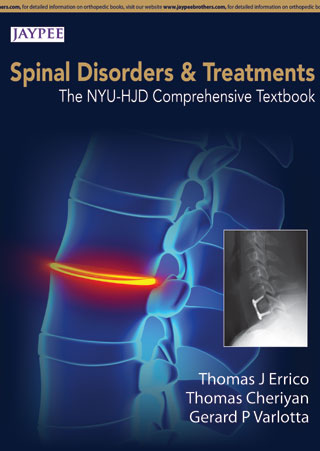 SPINE DISORDERS AND TREATMENTS:THE NYU-HJD COMPREHENSIVE TEXTBOOK, 1/E, BY, THOMAS J ERRICO