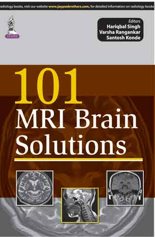 101 MRI BRAIN SOLUTIONS, 1/E, BY, HARIQBAL SINGH