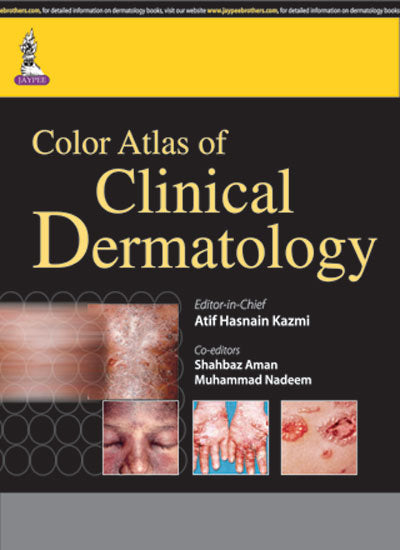 COLOR ATLAS OF CLINICAL DERMATOLOGY, 1/E, BY, KAZMI ATIF HASNAIN
