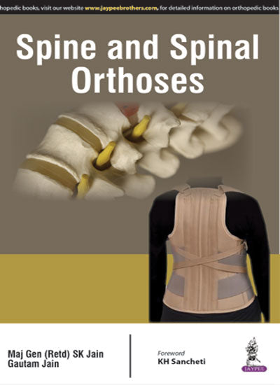 SPINE AND SPINAL ORTHOSES 1/E, 2016, SK JAIN