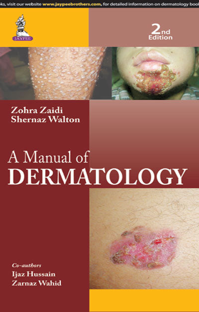 A MANUAL OF DERMATOLOGY, 2/E, BY, ZOHRA ZAIDI