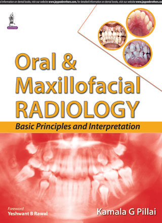 ORAL & MAXILLOFACIAL RADIOLOGY BASIC PRINCIPLES AND INTERPRETATION, 1/E, BY, KAMALA G PILLAI