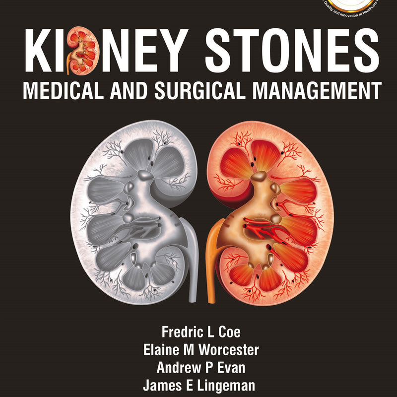 KIDNEY STONES: MEDICAL AND SURGICAL MANAGEMENT, 2/E, BY, FREDRIC L COE