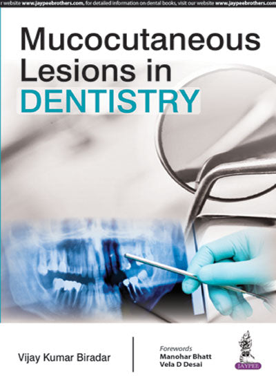 MUCOCUTANEOUS LESIONS IN DENTISTRY, 1/E, BY, VIJAY KUMAR BIRADAR