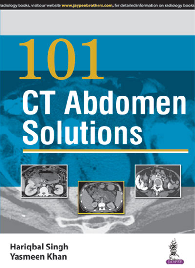 101 CT ABDOMEN SOLUTIONS, 1/E, BY, HARIQBAL SINGH