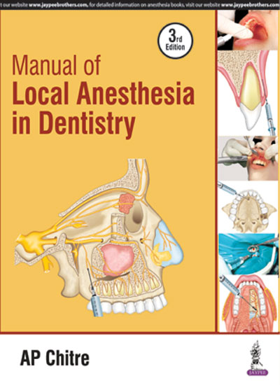 MANUAL OF LOCAL ANESTHESIA IN DENTISTRY 3/E R.P., 2025, AP CHITRE