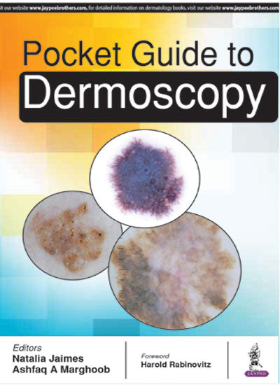 POCKET GUIDE TO DERMOSCOPY 1/E, 2017, NATALIA JAIMES