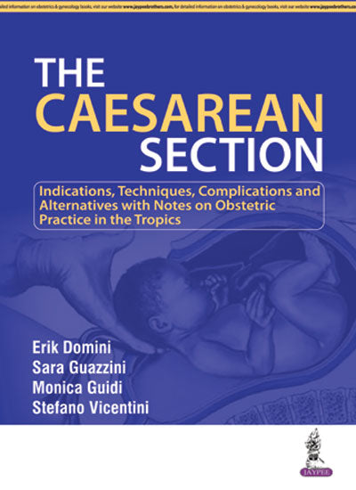 THE CAESAREAN SECITON, 1/E, BY, ERIK DOMINI