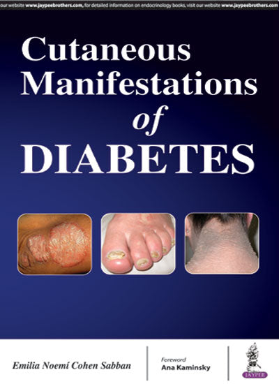 CUTANEOUS MANIFESTATIONS OF DIABETIES, 1/E, BY, EMILIA NOEMI COHEN SABBAN