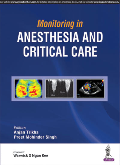 MONITORING IN ANESTHESIA AND CRITICAL CARE, 1/E, BY, ANJAN TRIKHA
