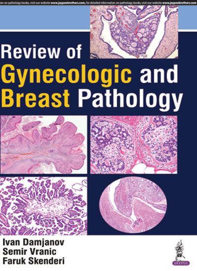 REVIEW OF GYNECOLOGIC AND BREAST PATHOLOGY 1/E, 2017, DAMJANOV IVAN