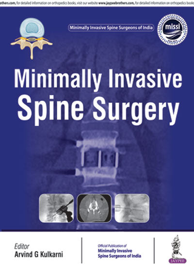 MINIMALLY INVASIVE SPINE SURGERY(OFFICIAL PUBLICATION OF MINIMALLY INVASIVE SPINE SURGEONS OF INDIA), 1/E, BY, ARVIND G KULKARNI