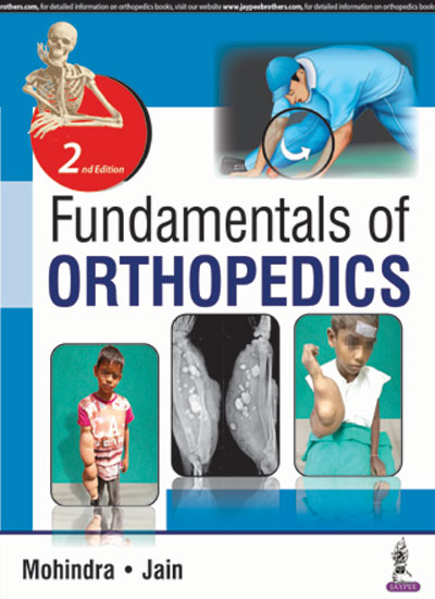 FUNDAMENTALS OF ORTHOPEDICS, 2/E, BY, MUKUL MOHINDRA