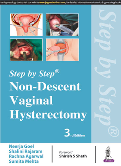 STEP BY STEP NON-DESCENT VAGINAL HYSTERECTOMY, 3/E, BY, NEERJA GOEL