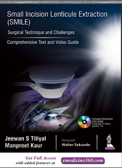 SMALL INCISION LENTICULE EXTRACTION (SMILE) SURGICAL TECHNIQUE AND CHALLENGES:COMPREHENSIVE TEXT, 1/E, BY, JEEWAN S TITIYAL
