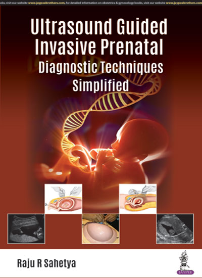 ULTRASOUND GUIDED INVASIVE PRENATAL DIAGNOSTIC TECHNIQUES SIMPLIFIED, 1/E R.P., BY, RAJU R SAHETYA