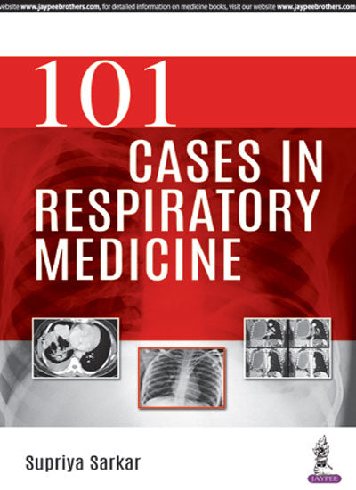 101 CASES IN RESPIRATORY MEDICINE, 1/E,R.P., SUPRIYA SARKAR