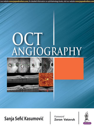 OCT ANGIOGRAPHY, 1/E, BY, SANJA SEFIC KASUMOVIC