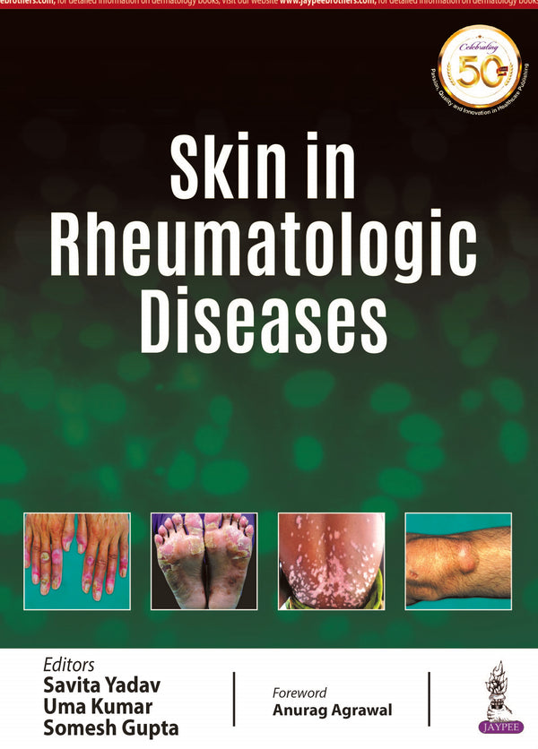 SKIN IN RHEUMATOLOGIC DISEASES, 1/E, BY, SAVITA YADAV