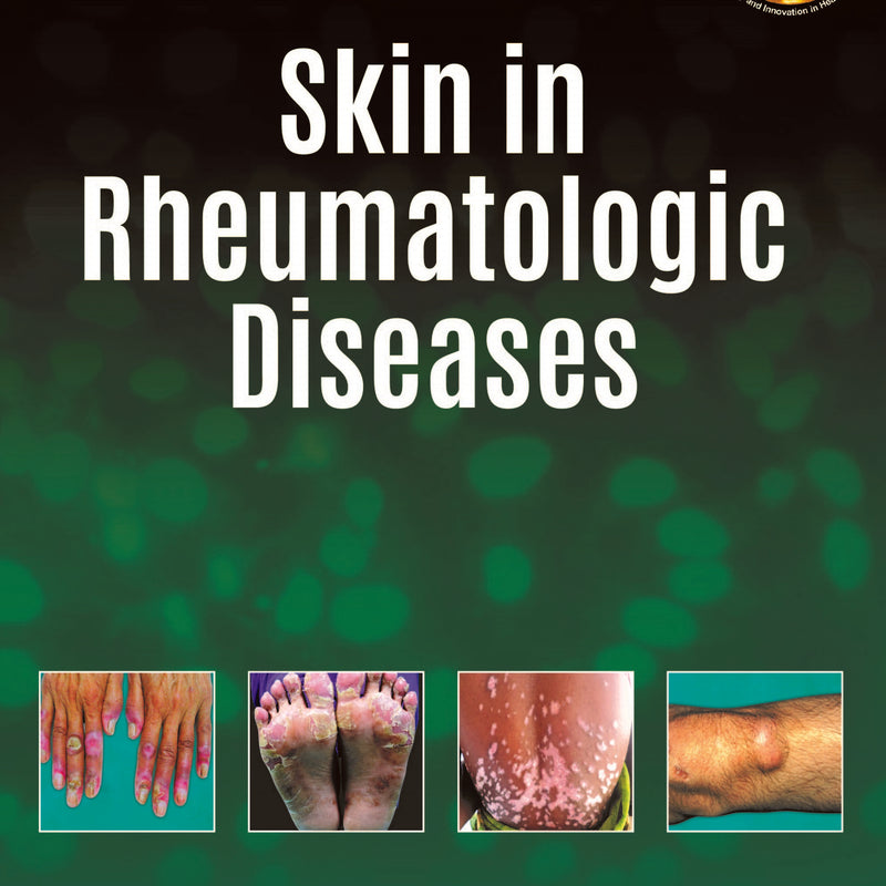 SKIN IN RHEUMATOLOGIC DISEASES, 1/E, BY, SAVITA YADAV