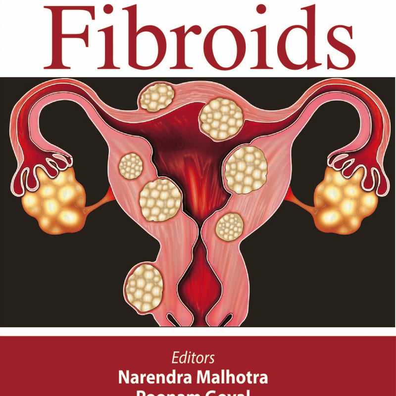 FIBROIDS, 1/E, BY, NARENDRA MALHOTRA