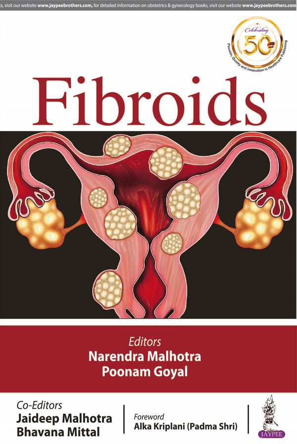 FIBROIDS, 1/E, BY, NARENDRA MALHOTRA