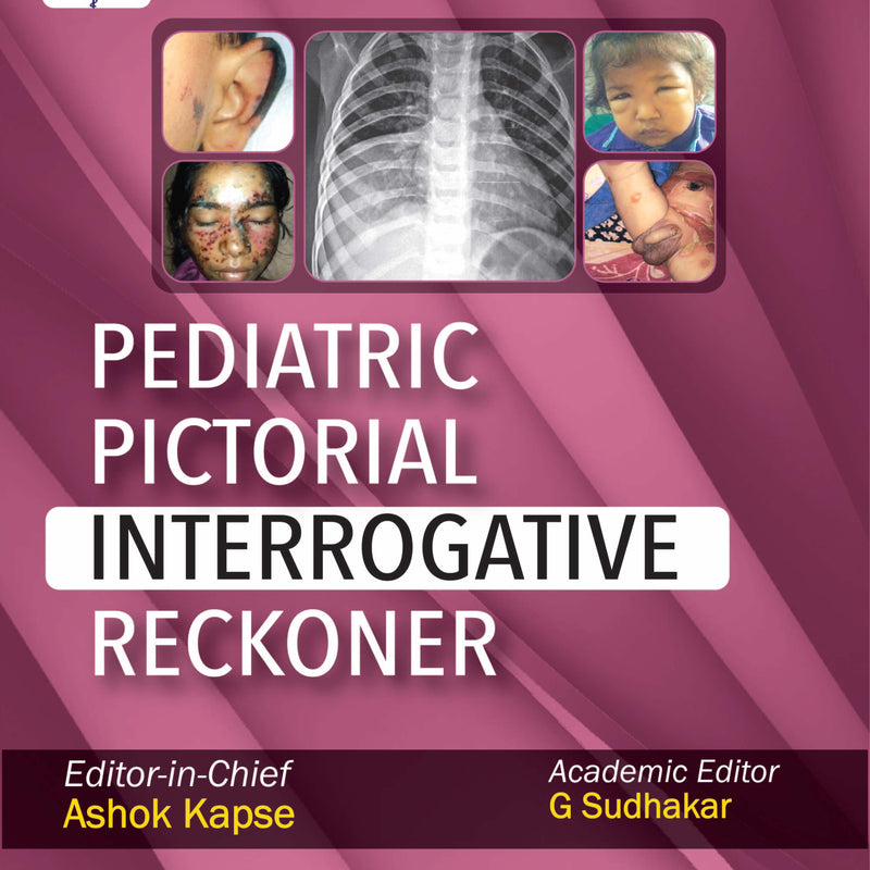 PEDIATRIC PICTORIAL INTERROGATIVE RECKONER 1/E, 2019, ASHOK KAPSE