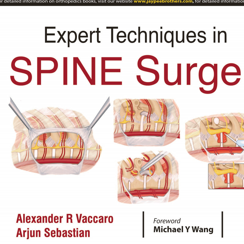 EXPERT TECHNIQUES IN SPINE SURGERY, 1/E, BY, ALEXANDER R VACCARO