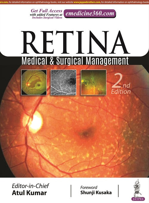RETINA: MEDICAL & SURGICAL MANAGEMENT 2/E, 2022, ATUL KUMAR