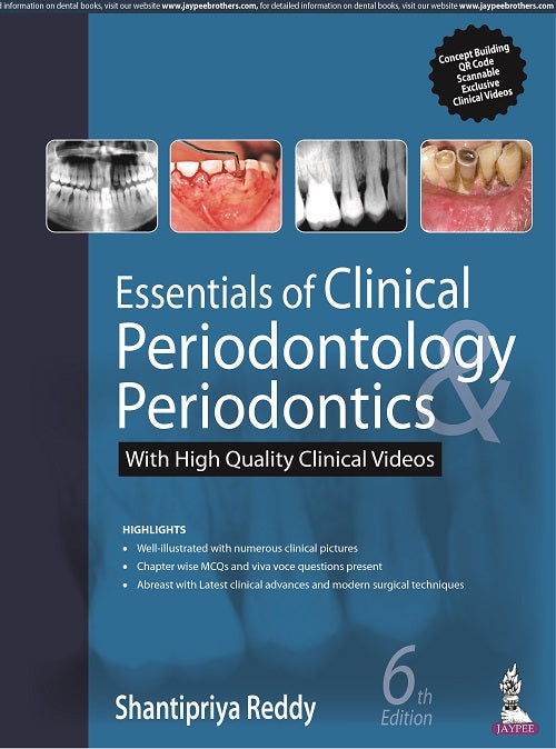 ESSENTIALS OF CLINICAL PERIODONTOLOGY & PERIODONTICS WITH HIGH QUALITY CLINICAL VIDEOS 6/E R.P., 2024, SHANTIPRIYA REDDY