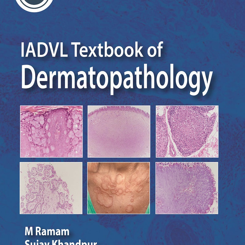 IADVL TEXTBOOK OF DERMATOPATHOLOGY, 1/E R.P., BY, M RAMAM